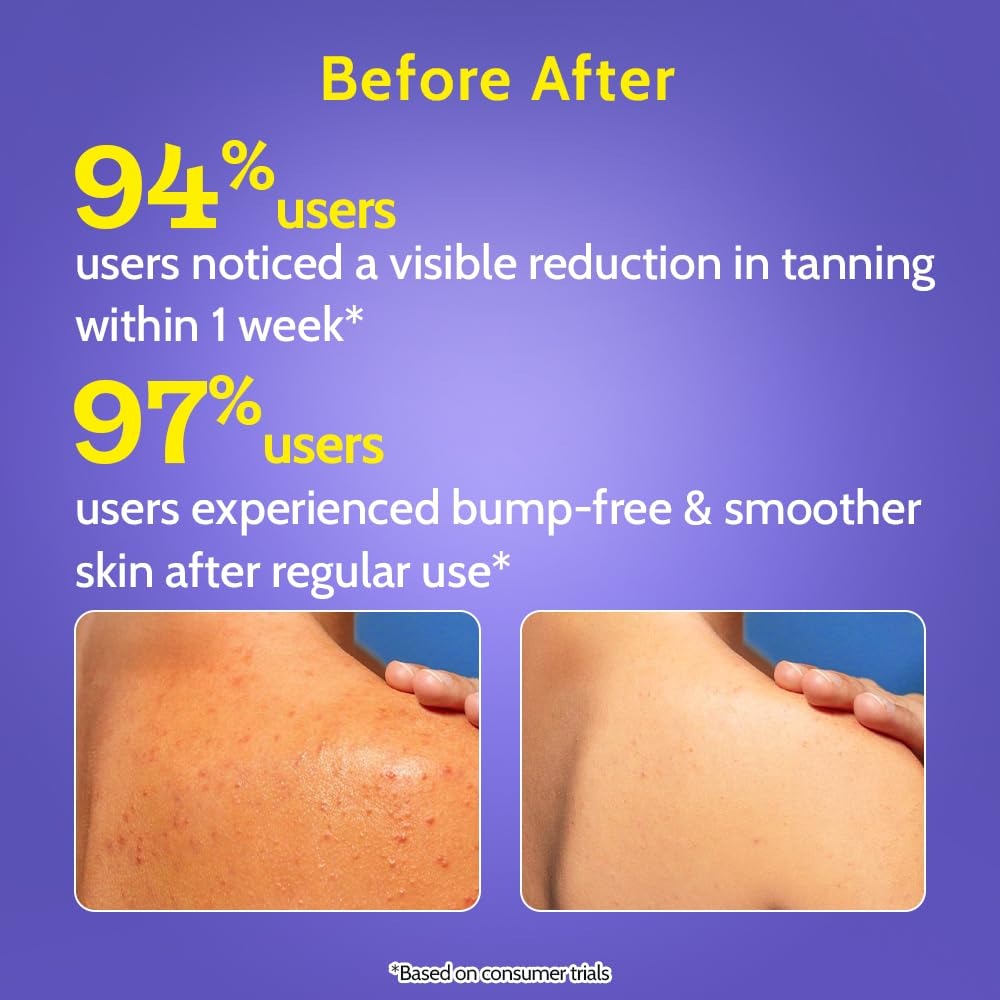 Chemist At Play Exfoliating Body Wash 236ml | Removes Tan, Fights Body Acne, Strawberry Skin | 4% (Salicylic Acid, Vitamin E & Lactic Acid) | Gentle Exfoliating