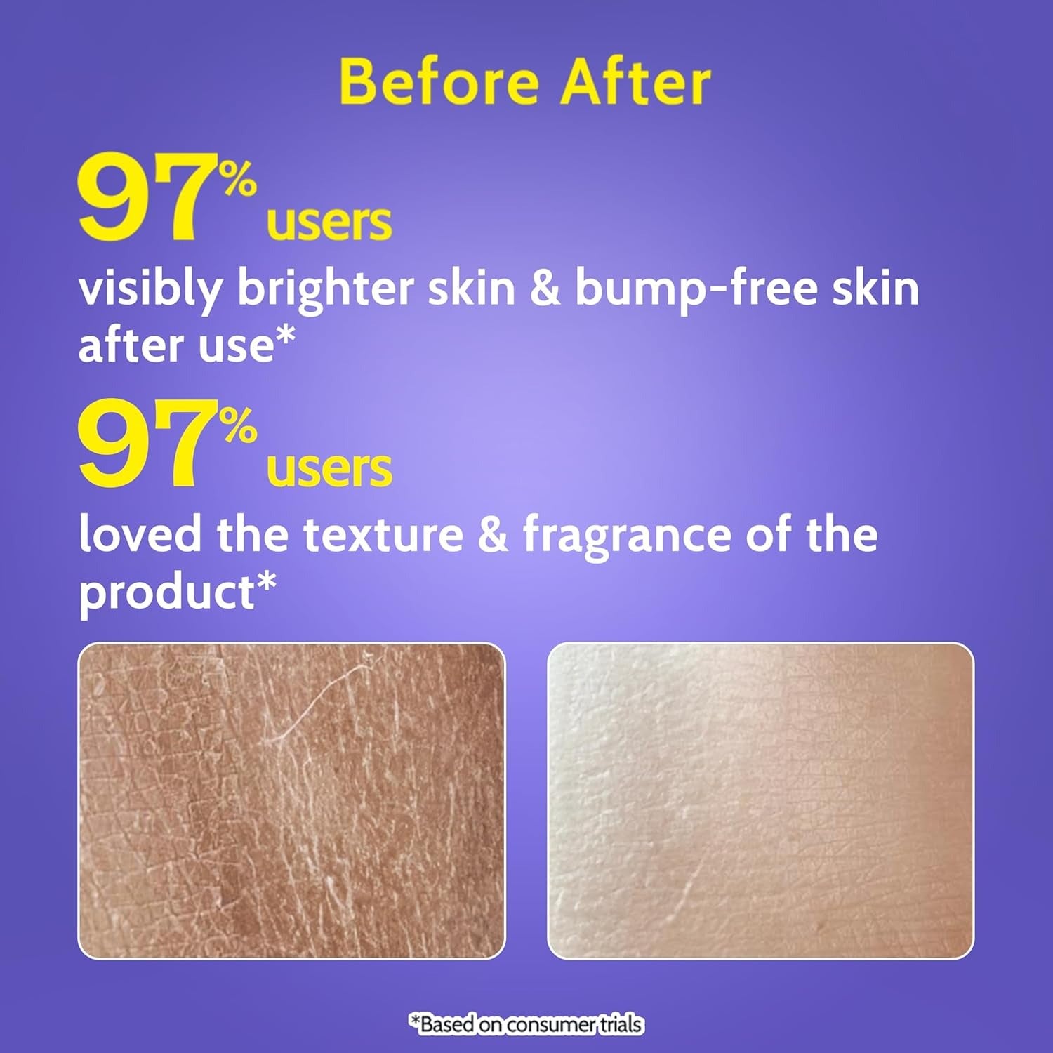 Chemist At Play Exfoliating Body Wash | Removes Tan, Fights Body Acne, Strawberry Skin | 4% (Salicylic Acid, Vitamin E & Lactic Acid)