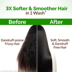 Mamaearth Lemon Anti-Dandruff Conditioner with Lemon, Aloe Vera for Itchy & Flaky Scalp | 3X Softer Hair & Up to 100% Dandruff Reduction in 1 Wash