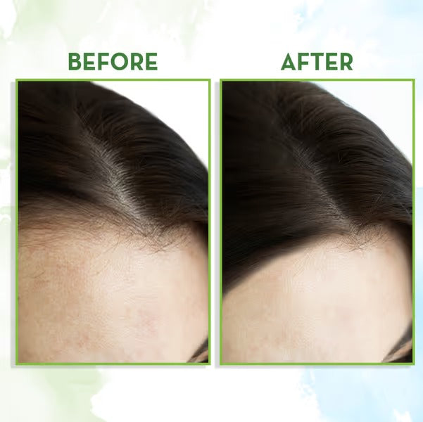 Rosemary Hair Growth Oil with Rosemary & Methi Dana for Promoting Hair Growth - 100 ml