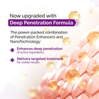 The Derma Co Sali-Cinamide Anti-Acne Face Serum - 30 ml | Fights active acne | Fades acne marks & scars | Controls excess oil | Unclogs pores | Reduces redness