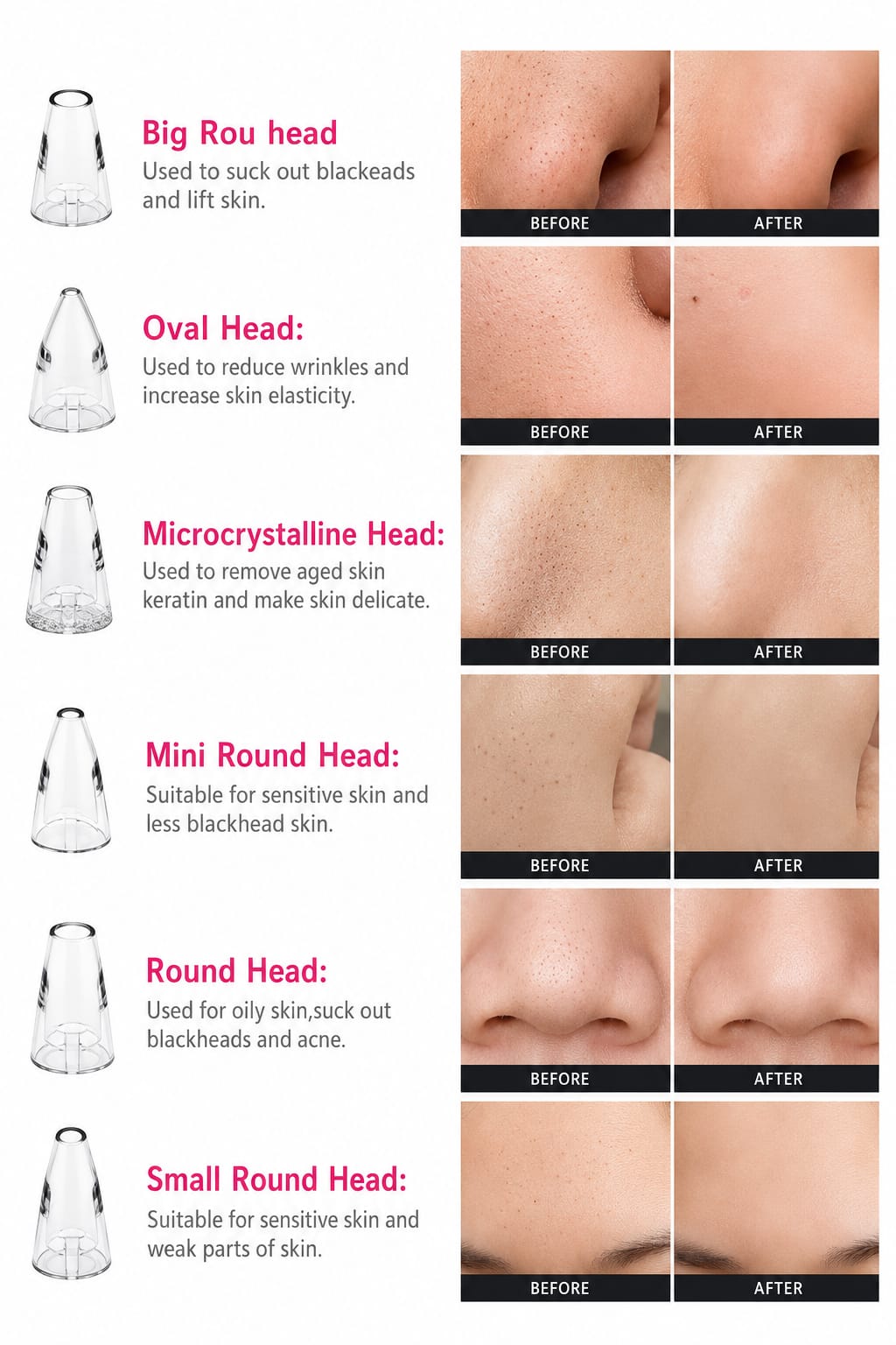 |Face Cleaner | Multi- Functional Cleaninig | Remove Blackhead & Whitehead Device | pore care device | Compact Personal skincare Tool |