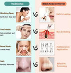 |Face Cleaner | Multi- Functional Cleaninig | Remove Blackhead & Whitehead Device | pore care device | Compact Personal skincare Tool |